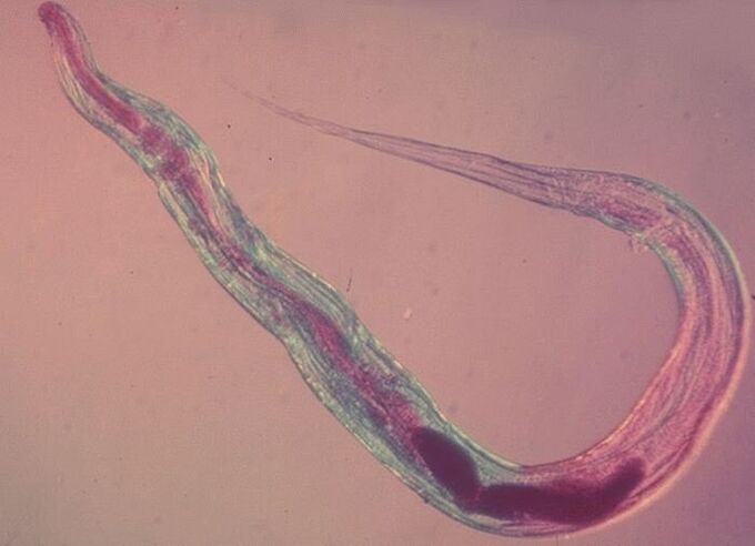 Pinworm onder de microscoop