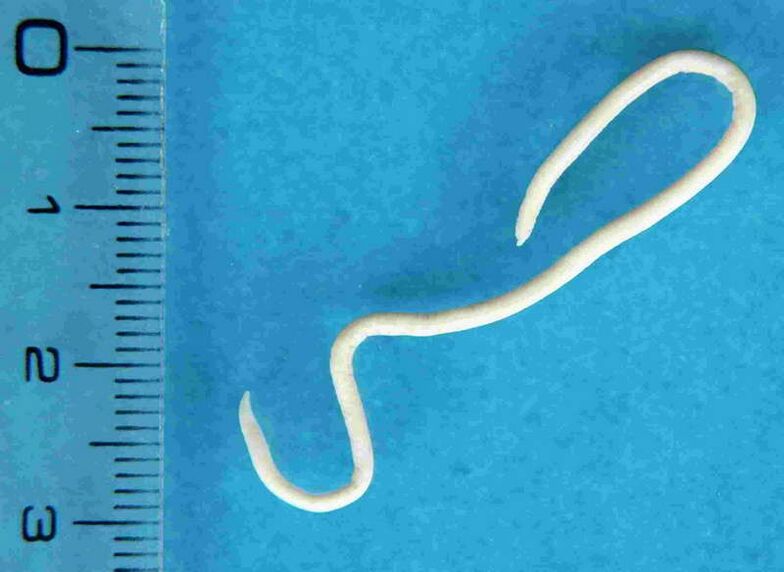 worm uit het menselijk lichaam