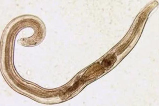 de menselijke parasieten pinworm